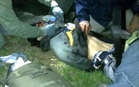 El sospechoso antes de ser llevado al hospital con un tiro en la boca. 