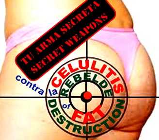 Teatro Thalia celulitis