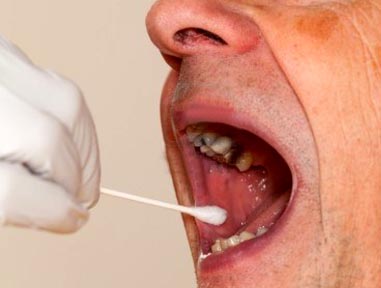 Así se toma la prueba de ADN, utilizando la saliva.