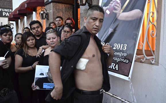 Carlos Reyes mostrando su herida de aquella noche fatídica. 