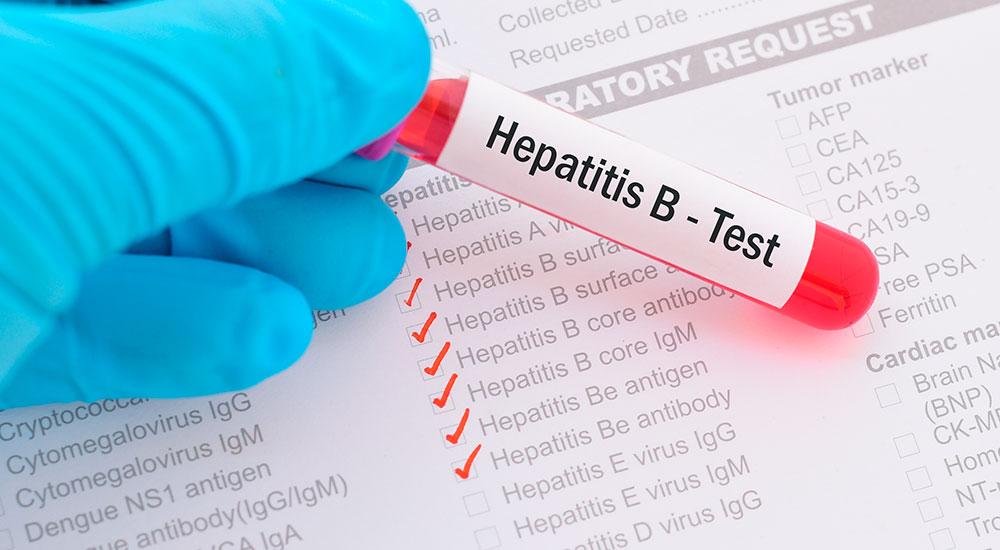 Día Nacional de Concientización sobre Hepatitis